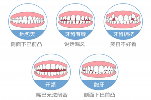 龋齿和磨损区别（牙齿磨损和磨耗的区别）常见问题解读！(图1)
